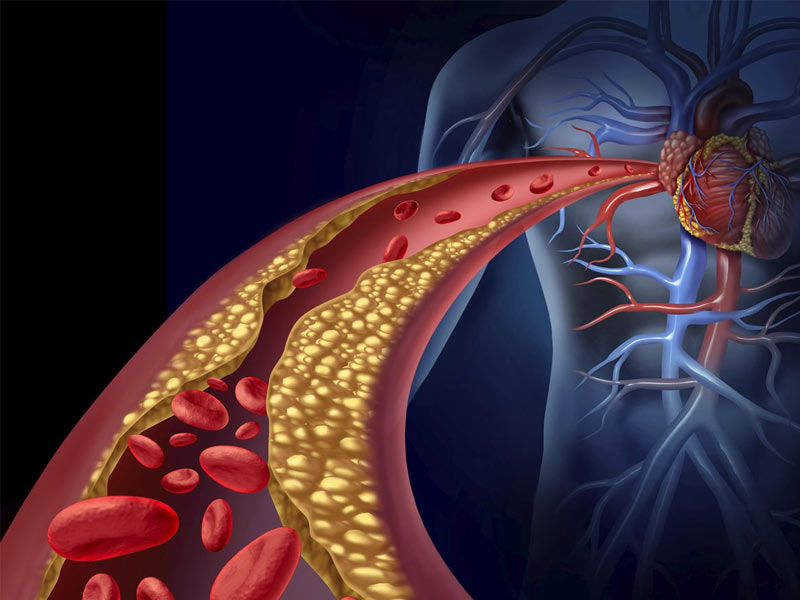 cholesterol in blood