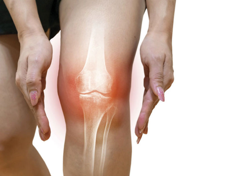 osteoarthritis in knee