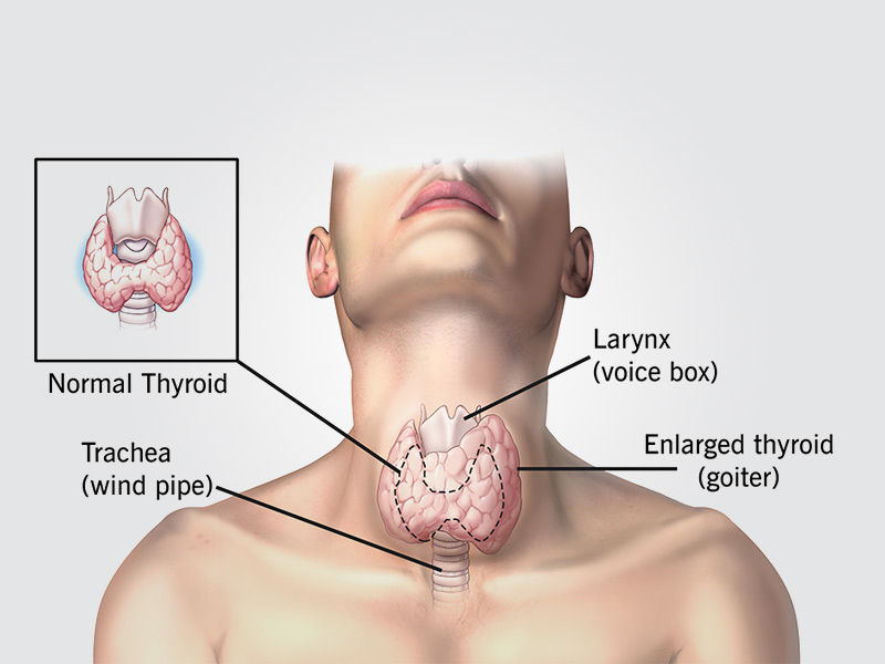 thyroid symptoms