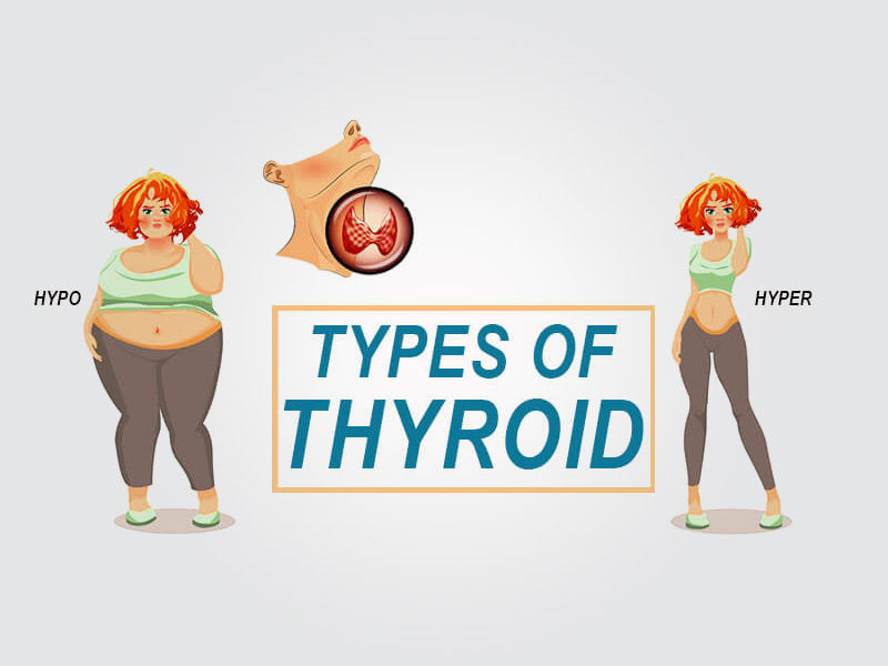 types of thyroid