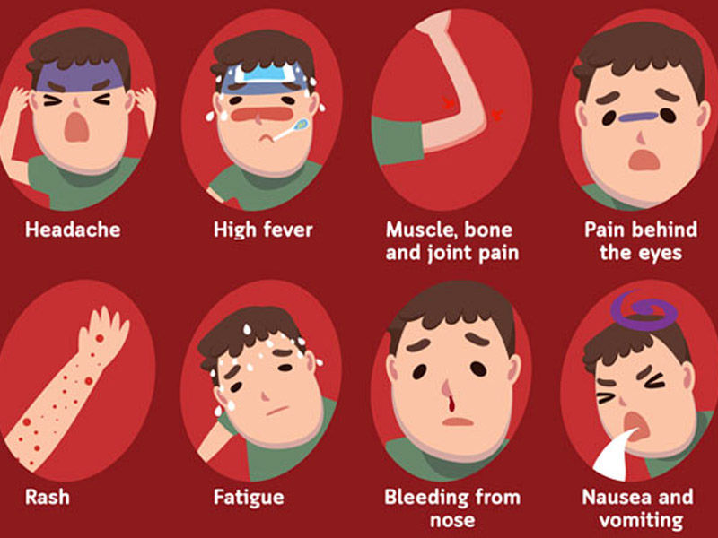 Dengue symptoms