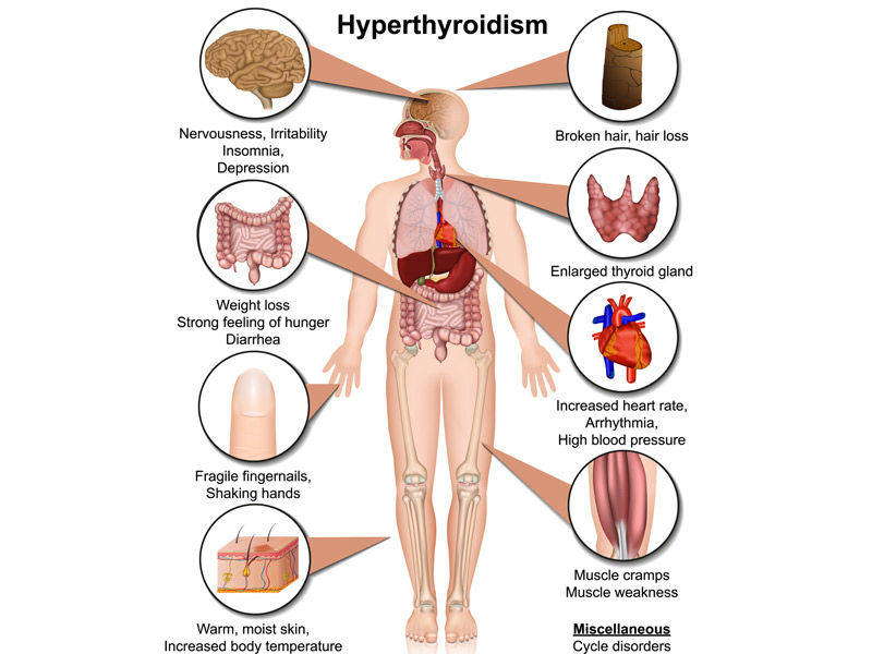 hormonal imbalance, hormonal imbalance prevention, hormonal imbalance facts, how to control hormonal imbalance, hormonal imbalance treatment, hormonal imbalance treatment, hormonal imbalance in women, hormonal imbalance meaning,