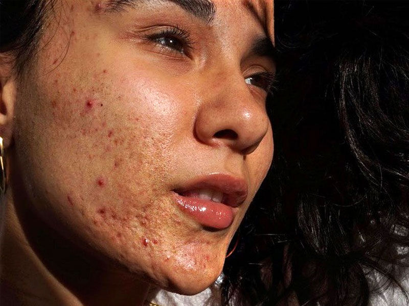 ,,empowering women ,,empowering women quotes ,empowering women songs ,empowering women movies ,empowering women books ,empowering women physicians ,empowering women meaning ,empowering women in the workplace ,empowering women in history ,empowering women speech ,empowering women's day quotes ,woman empower meaning ,why female empowerment is important ,empowering women's names ,what is women's empowerment all about ,women's day empowering quotes ,dimensions of women's empowerment ,what is an empowered woman ,women's empowerment principles companies ,empowering women essay