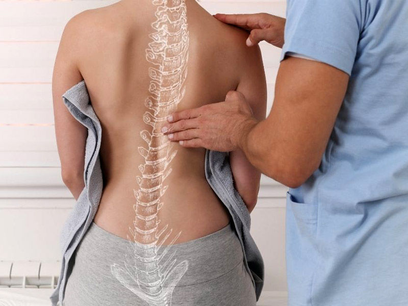 scoliosis, scoliosis treatment, scoliosis definition, scoliosis surgery, what causes scoliosis, mild scoliosis, lumbar scoliosis, scoliosis brace, types of scoliosis, scoliosis icd 10, idiopathic scoliosis, scoliosis awareness month, scoliosis and pregnancy, scoliosis and sciatica, scoliosis and hip pain, scoliosis as an adult, scoliosis arthritis, scoliosis assessment, scoliosis angle, scoliosis and chiropractor, adolescent idiopathic scoliosis