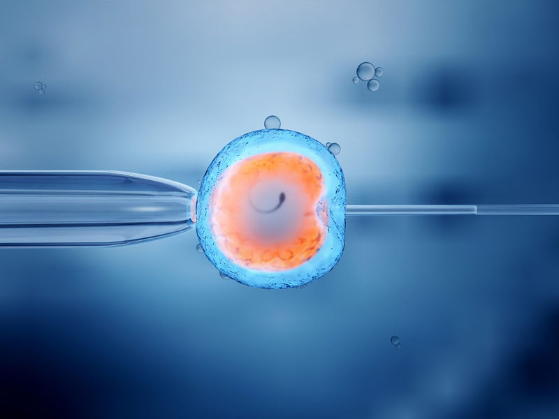 ,ivf meaning ,ivf cost ,iui vs ivf ,ivf due date calculator ,ivf process ,how much does ivf cost ,how does ivf work ,boston ivf ,ivf success rate ,jennifer aniston ivf ,ivf after tubal ligation