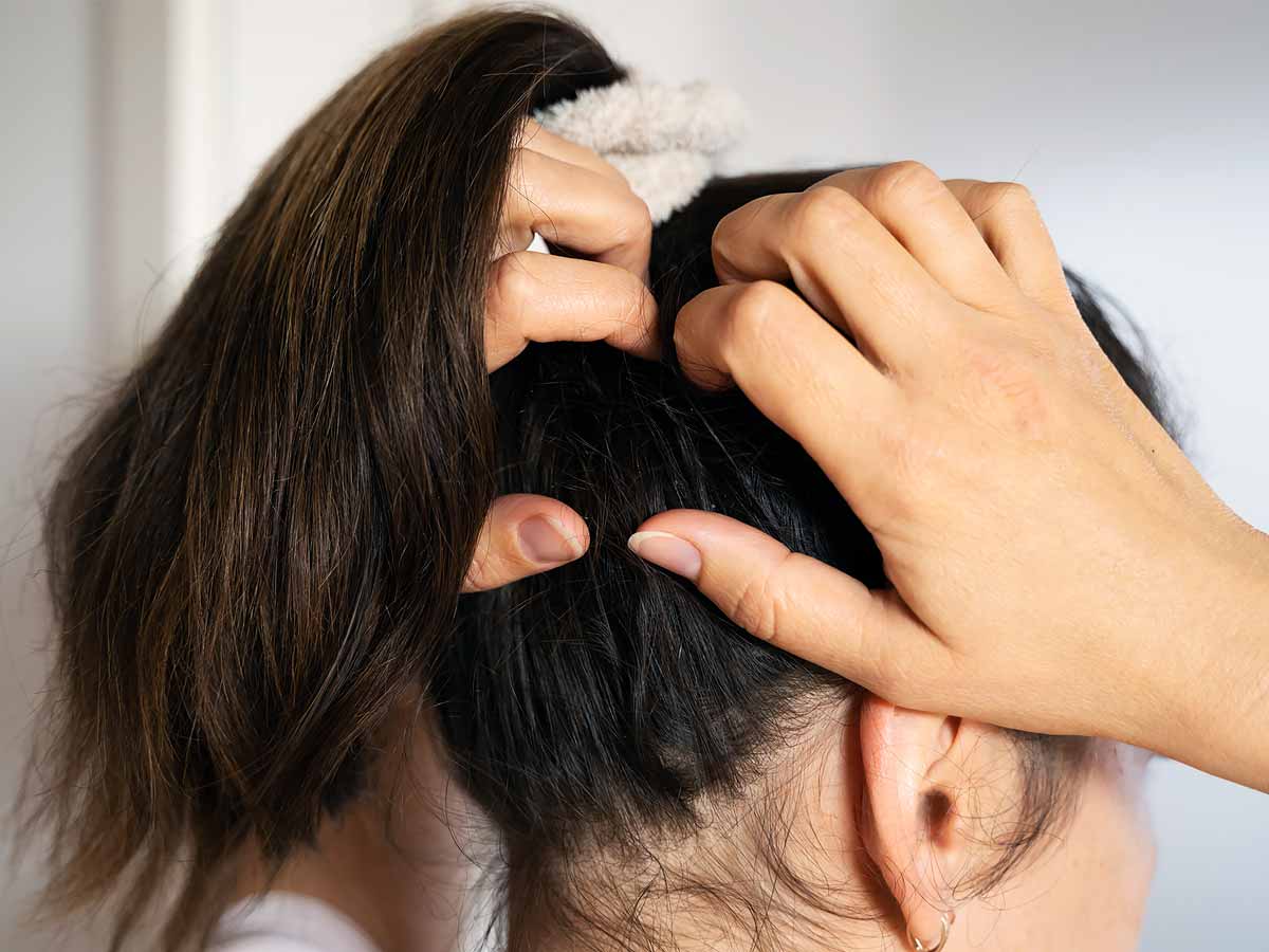 Dry scalp sale treatment at home