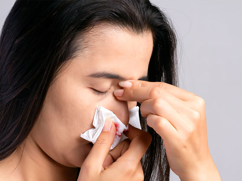 ,nosebleeding ,nose bleeding ,how to stop nose bleeding ,first aid for nose bleeding ,reasons for nose bleeding ,how to prevent nose bleeding ,dog nose bleeding ,nose bleeding cause ,what to do when you are nosebleeding ,nose bleeding in pregnancy ,nose bleeding while sleeping ,what causes nose bleeding ,nose bleeding a lot ,nose bleeding and headache
