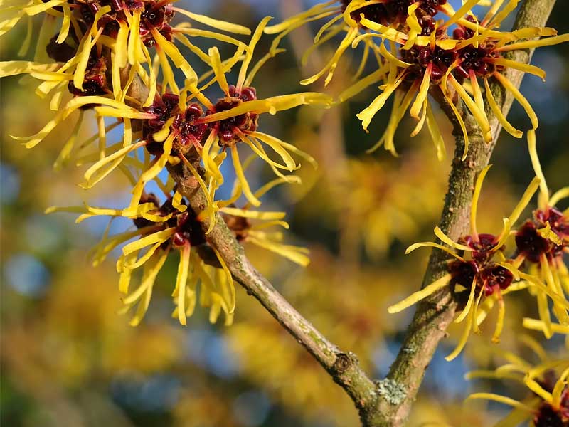 ,dry scalp
,dry scalp treatment
,dry scalp shampoo
,dry scalp vs dandruff
,best shampoo for dry scalp
,how to treat dry scalp
,what causes dry scalp
,dry scalp baby
,dry scalp remedy
,coconut oil for dry scalp
,itchy dry scalp
,dry scalp and hair loss