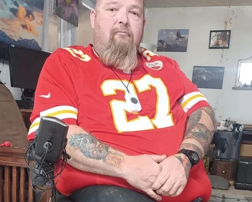 double amputee father