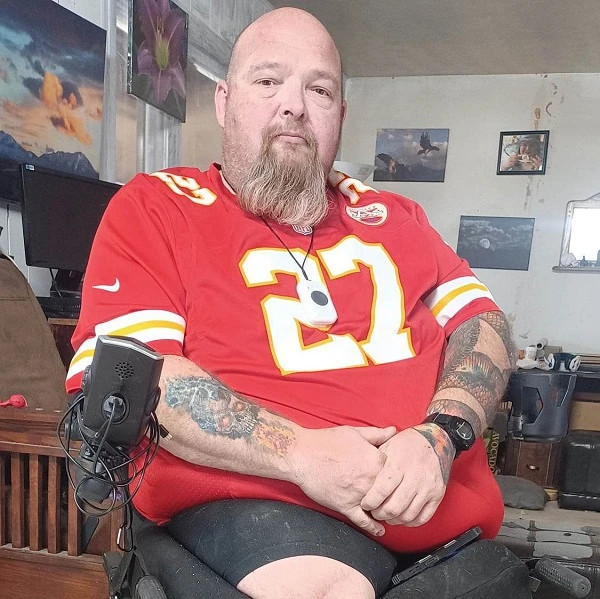 double amputee father