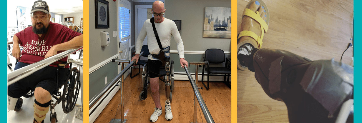 Three photos from Help Hope Live clients living with amputations. The first is a man seated in a wheelchair in a therapy environment, he has light skin, a dark beard, a ball cap, black shorts, and a red t-shirt and he is missing his right leg. The second is a man with a prosthetic on his left side who is gripping a therapy bar as he stands. He has light skin and a bald head and has a white athletic long sleeved shirt and black shorts. The third is a photo of a black prosthetic leg that ends in a light skin-colored foot attachment.