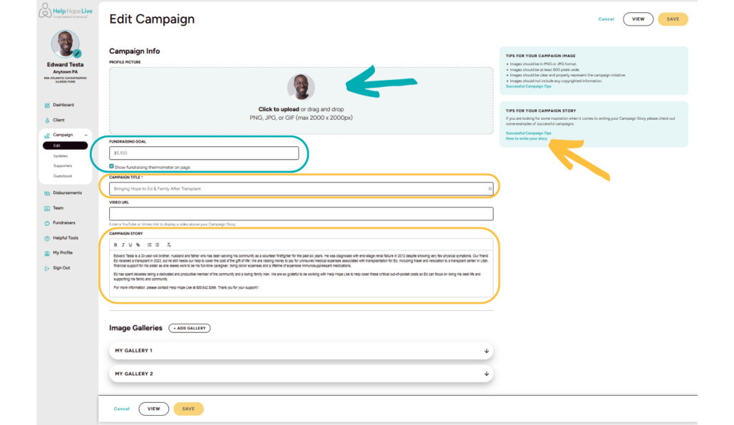 Help Hope Live Campaign edit options include customizing a photo, adding a goal, Campaign Title, and Campaign Story plus where to find tips for writing your story.
