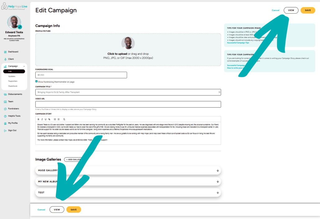 Help Hope Live client portal on desktop - arrows point to the white VIEW button at the bottom of the page and the top right of the page.