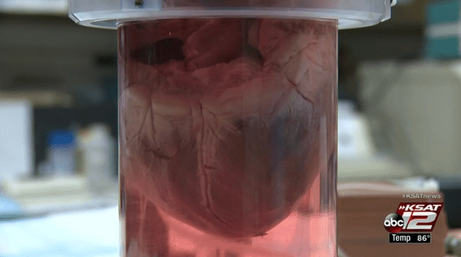 A heart in a jar on KSAT ABC 12