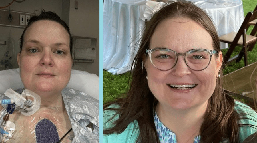 Two photos of heart transplant recipient Linda Jara. In one she is in the hospital. In the other she is smiling at an outdoor event. She has light skin, brown hair, and blue-gray eyes.