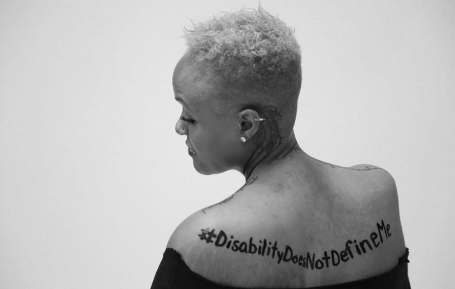 In a dramatic black and white portrait, Keisha Greaves lookes over her left shoulder with her eyes downcast. Painted across her back is #DisabilityDoesNotDefineMe. She has short curly hair, a feather-like tattoo behind her left ear, and a nose stud.