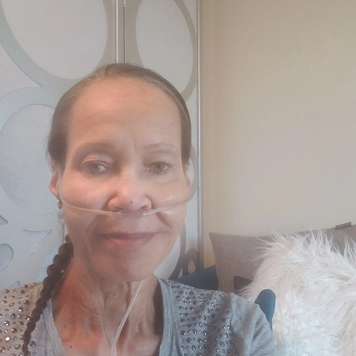 Lung transplant recipient Debra has light brown skin, a narrow brown braid, light eyes, and a breathing tube connected to her nose.