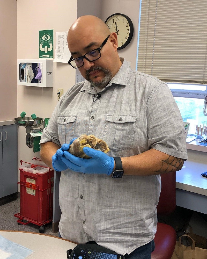 Kevin Lopez looks serious and pensive as he gazes down at his old heart, held in his hands in blue medical gloves. His old heart is a gray-yellow color and larger than an orange. He appears to be in a hospital check-up style room. He has light brown skin, a bald head, dark eyes, a salt-and-pepper goatee, and black-rimmed glasses, and he wears a gray and white striped button-up short-sleeved shirt. He has a cobweb tattoo partially visible on his left elbow.