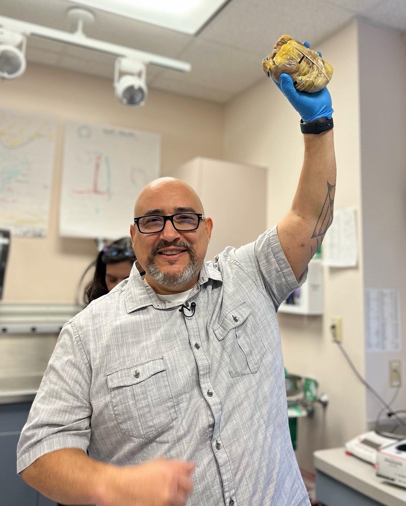 Kevin Lopez is smiling with a resigned yet happy expression as he literally holds his old heart in his hand, hoisting it far above his head with his left hand while wearing a blue medical glove. The heart is yellow-gray and cut into slies but kept together with a band, and it is larger than an orange. He appears to be in a hospital check-up style room. He has light brown skin, a bald head, dark eyes, a salt-and-pepper goatee, and black-rimmed glasses, and he wears a gray and white striped button-up short-sleeved shirt.