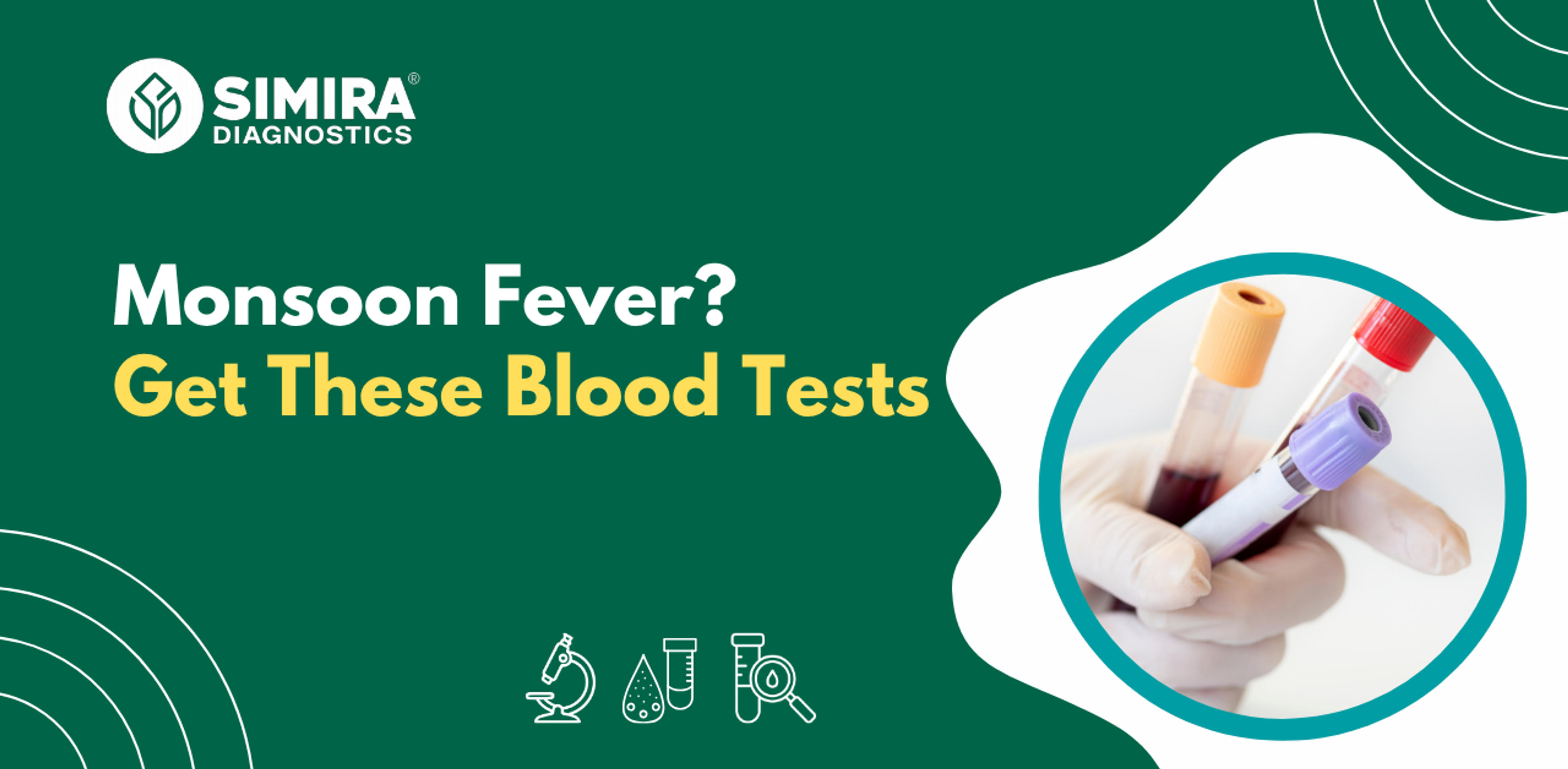 Blood Test for Monsoon Fever