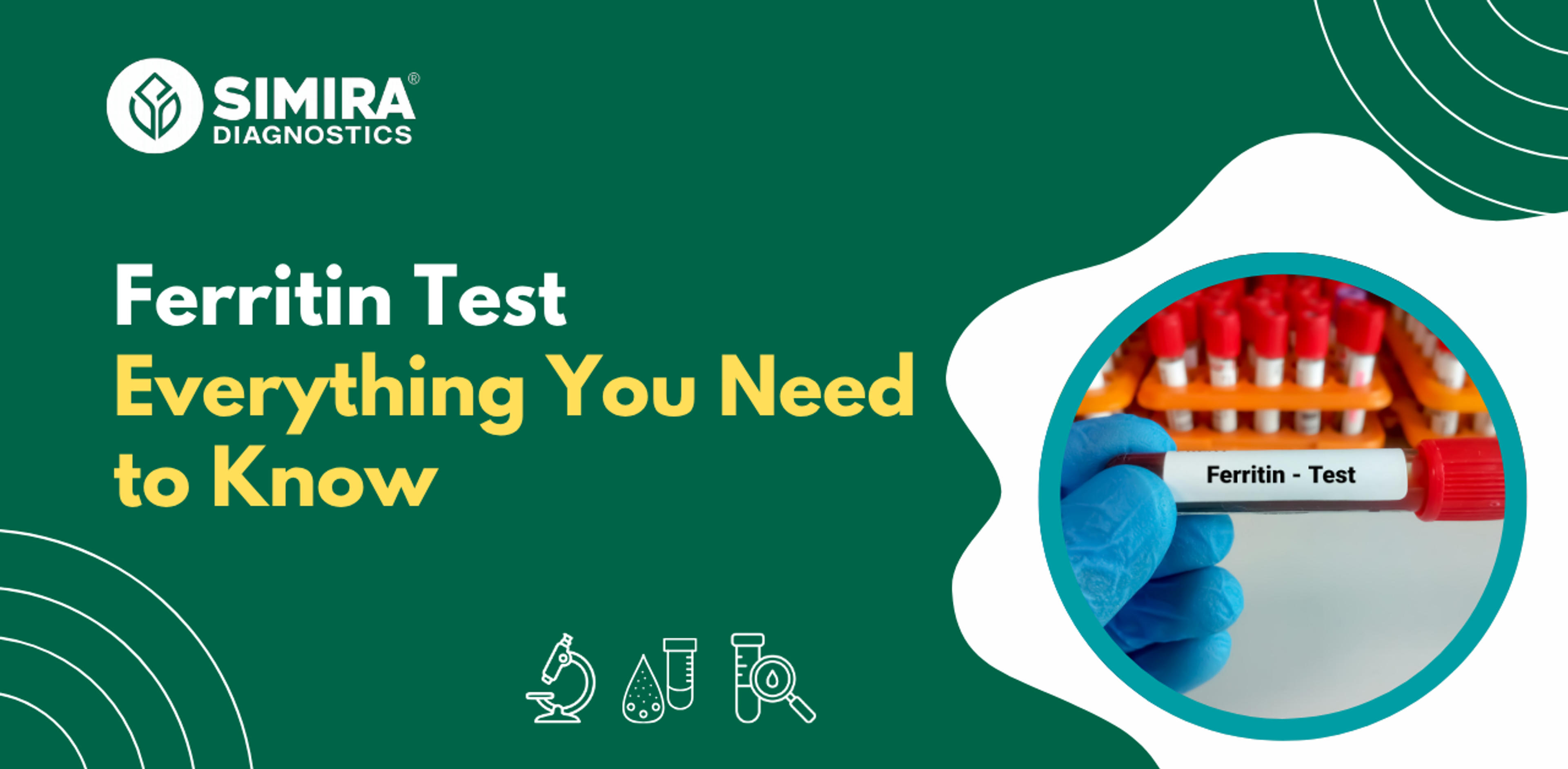 Ferritin test explaining normal ferritin levels, iron stores, iron deficiency, and test results