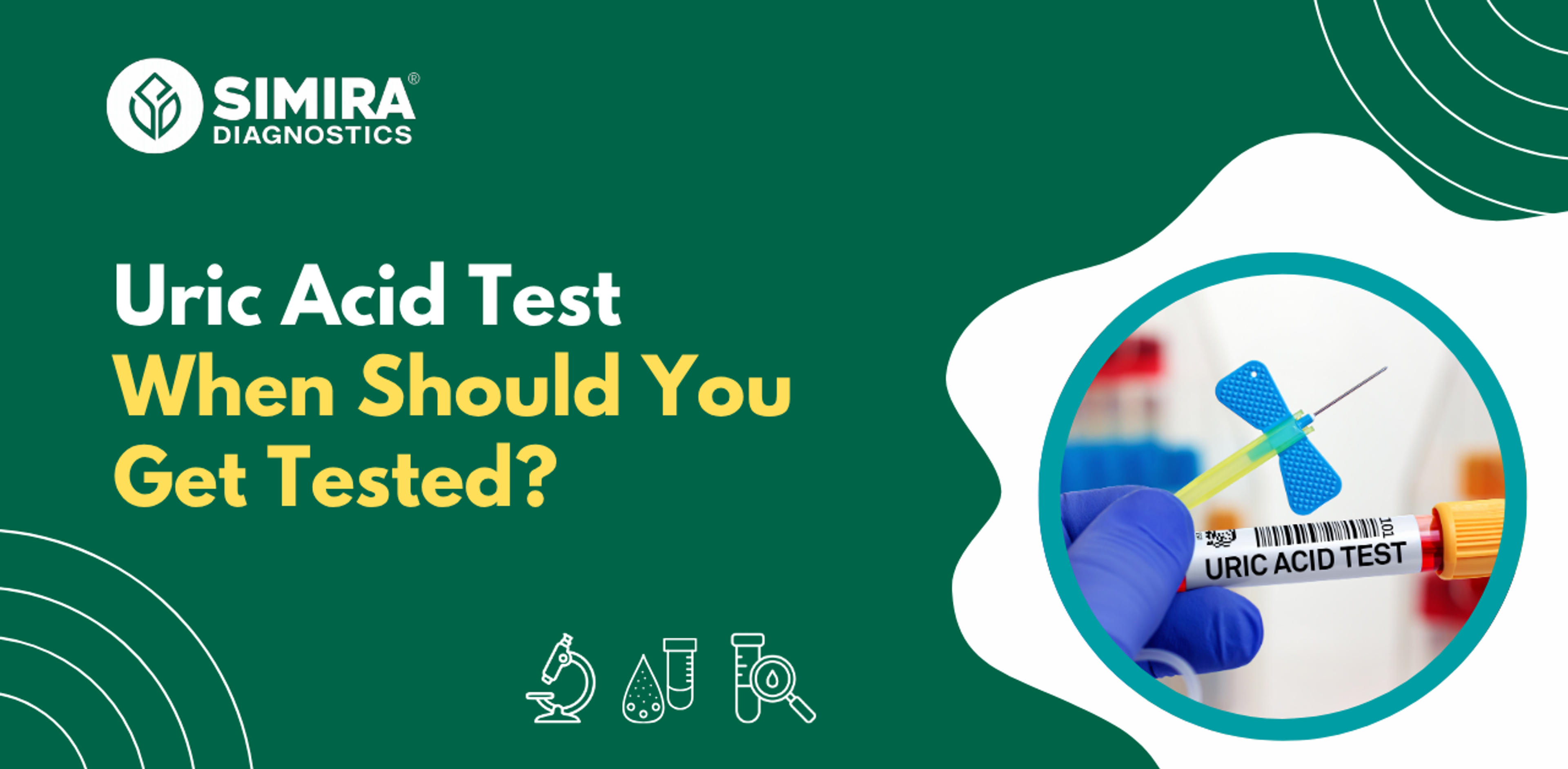 Uric acid test showing normal uric acid range, high uric acid levels, gout risk, and test results