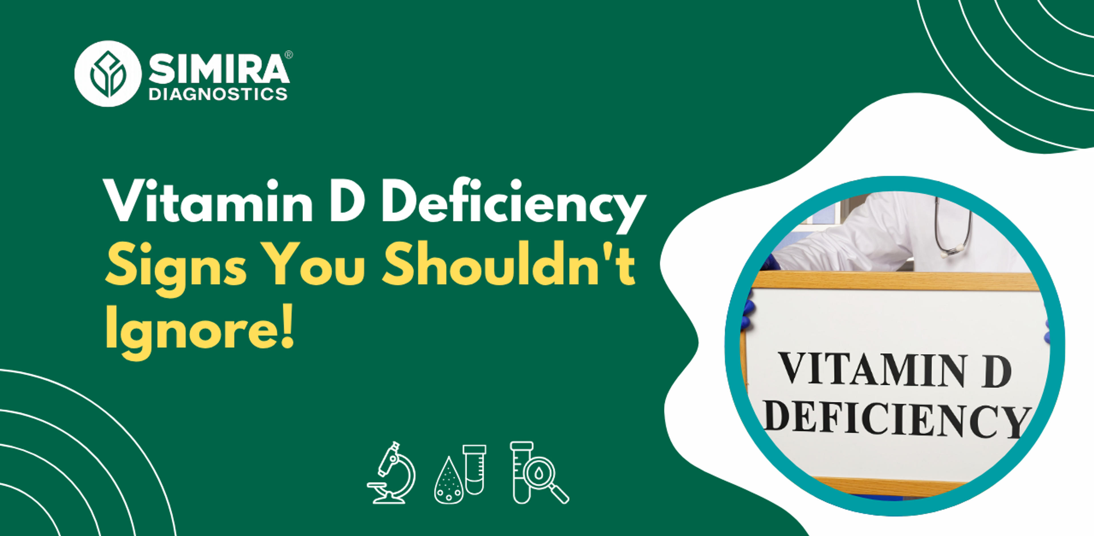 Vitamin D deficiency signs and symptoms highlighting the importance of vitamin D testing for overall health