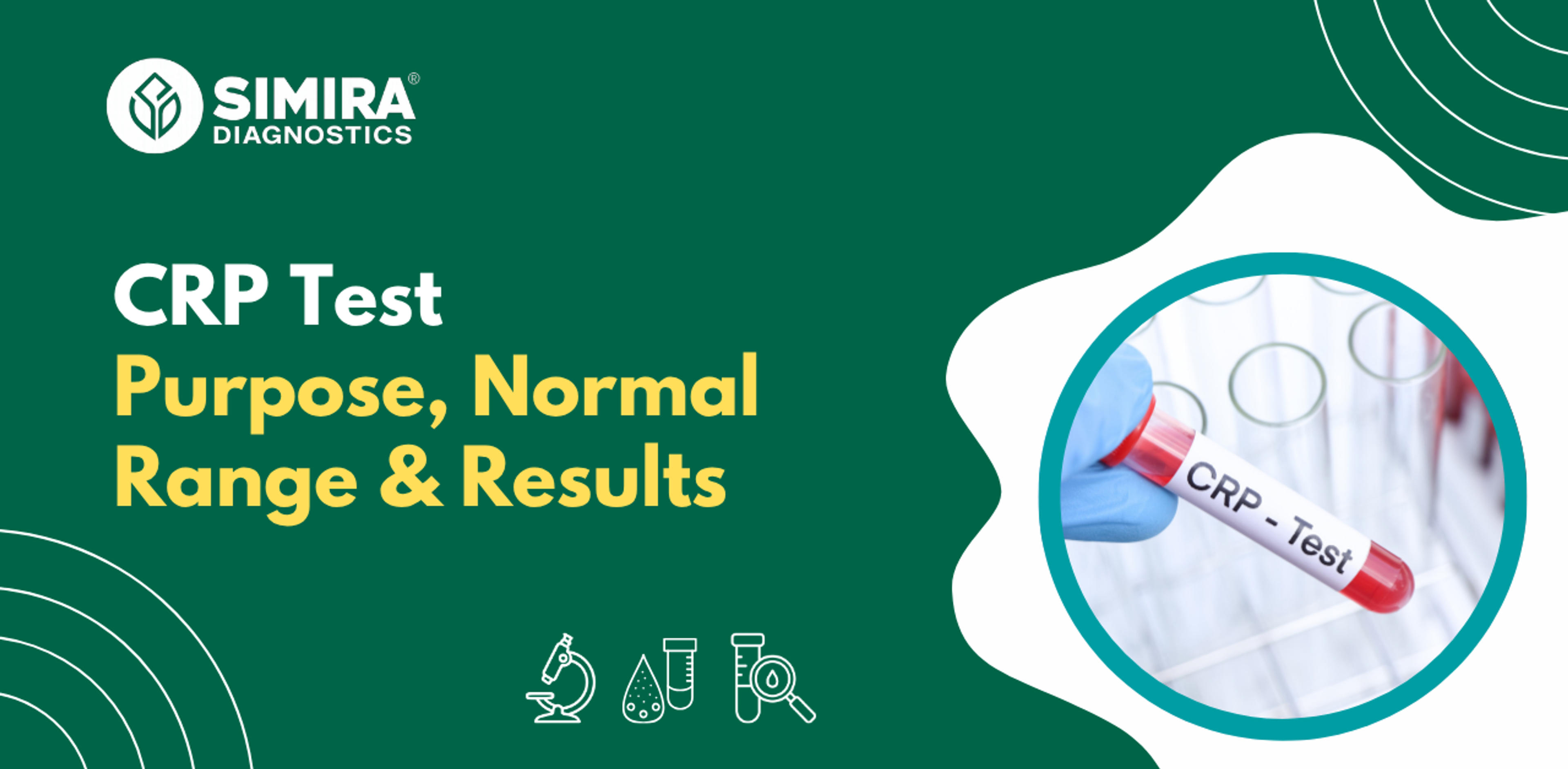 CRP test showing purpose, normal CRP range, high CRP levels, test results, and inflammation diagnosis