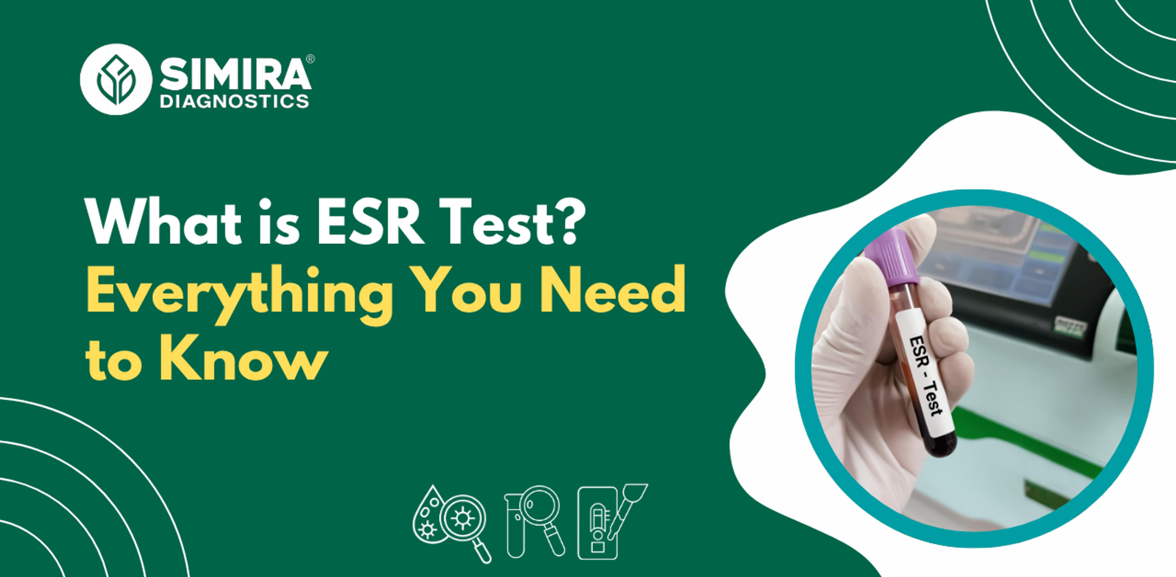 ESR blood test explaining how erythrocyte sedimentation rate measures inflammation in the body.