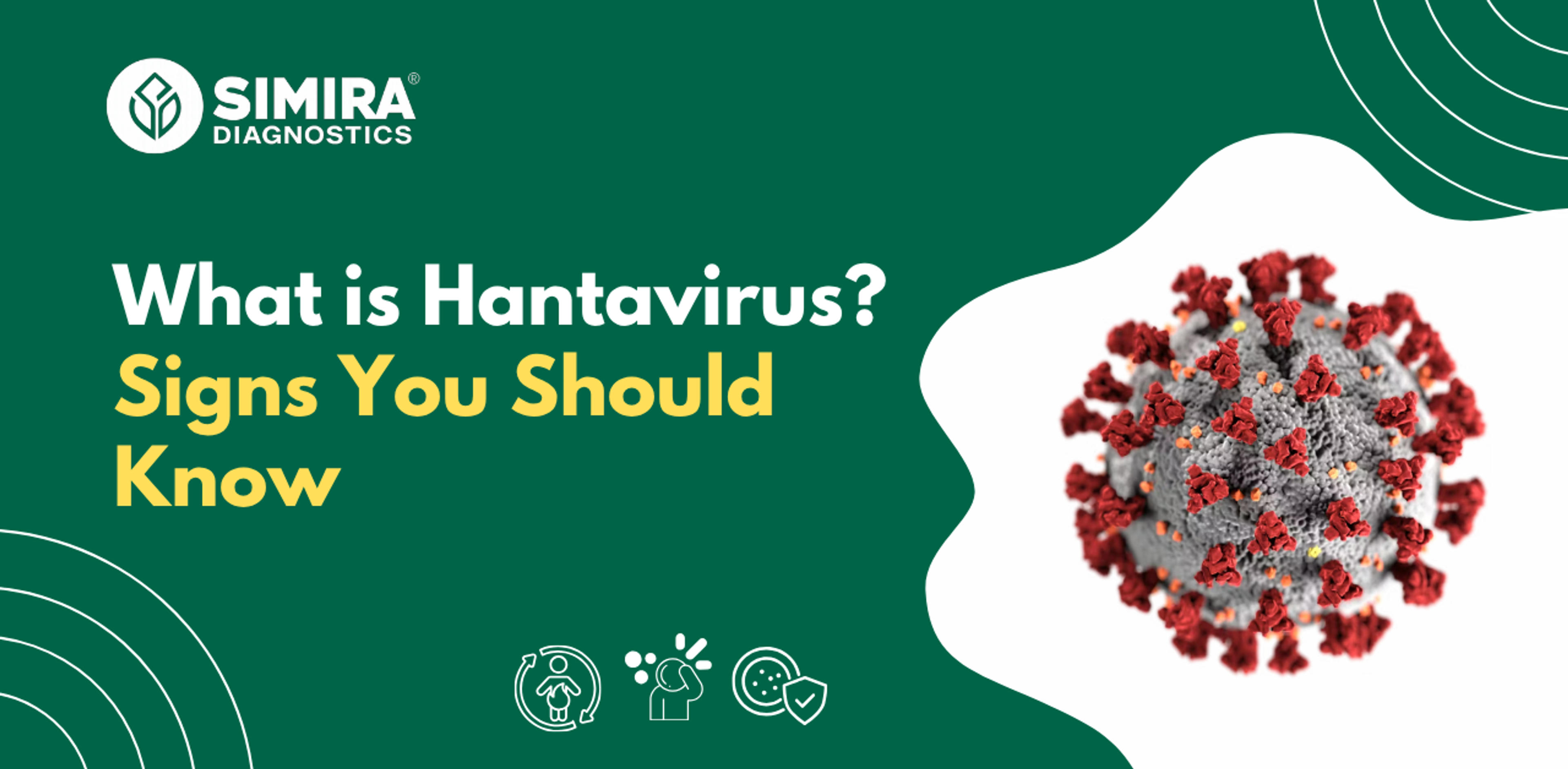 Hantavirus