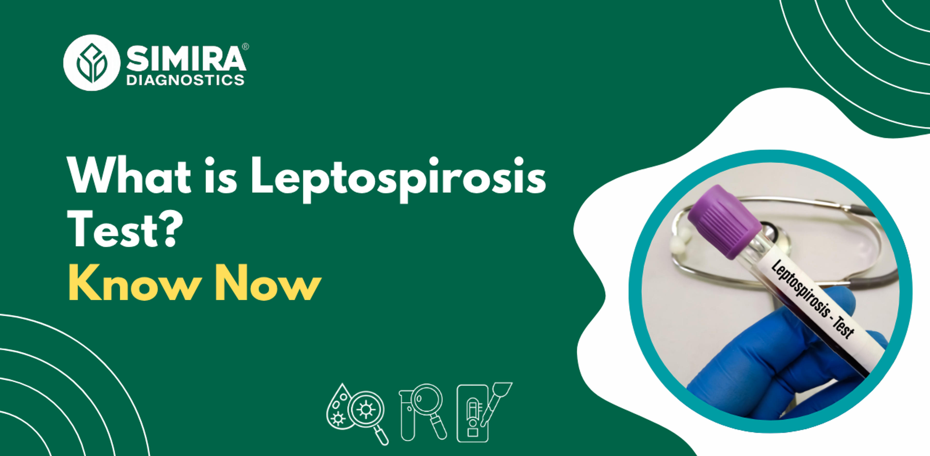 Leptospirosis blood test used to diagnose bacterial infection caused by Leptospira.l