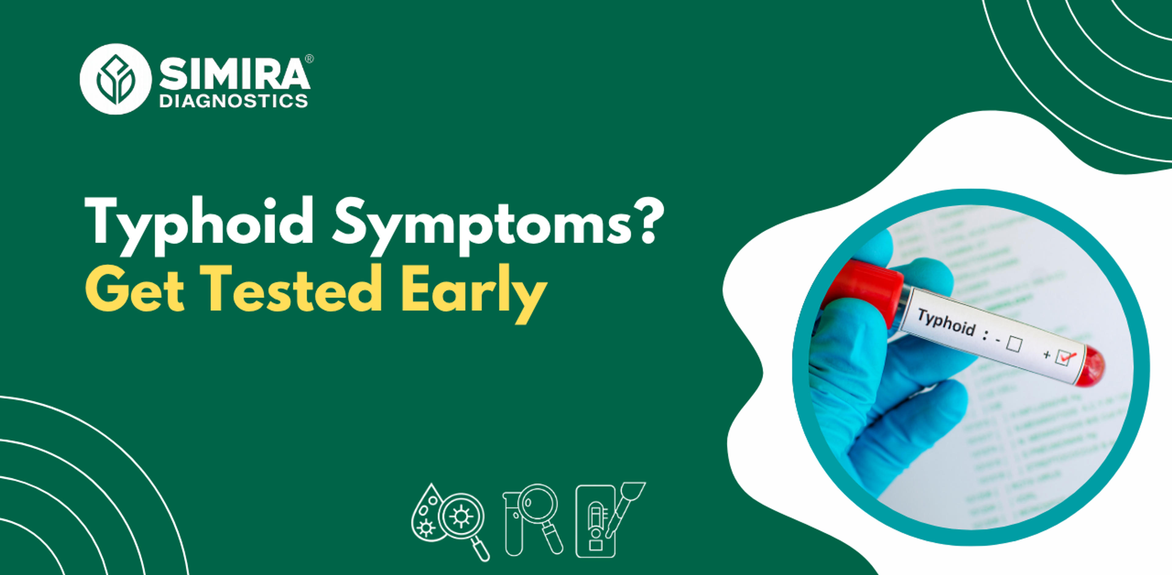 When should you get a typhoid test? Common symptoms and warning signs
