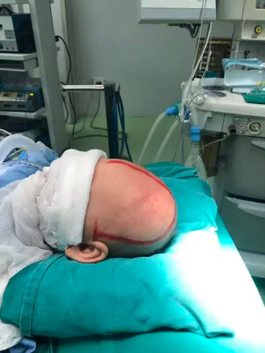 Phục hồi chức năng sau phẫu thuật não