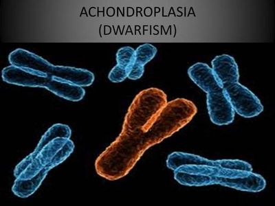 dwarfism karyotype