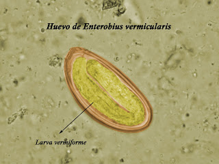 huevo de enterobio