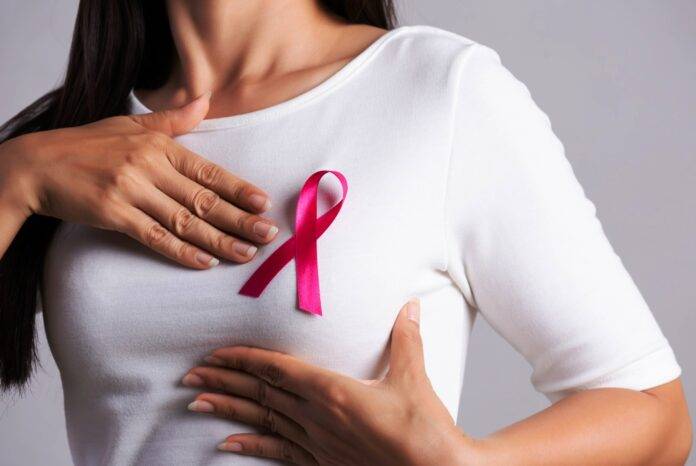 BREAST CANCER BY SNE IMAGE