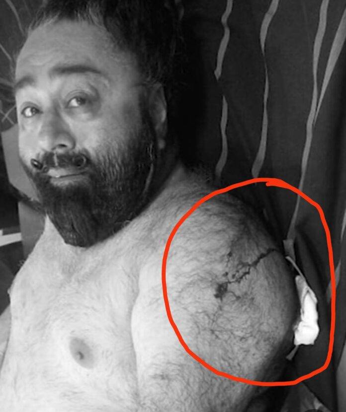 INJURED-CONGRESS-LEADER-AT-HOSPITAL