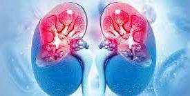 KIDNEY SCAM 19.4.23