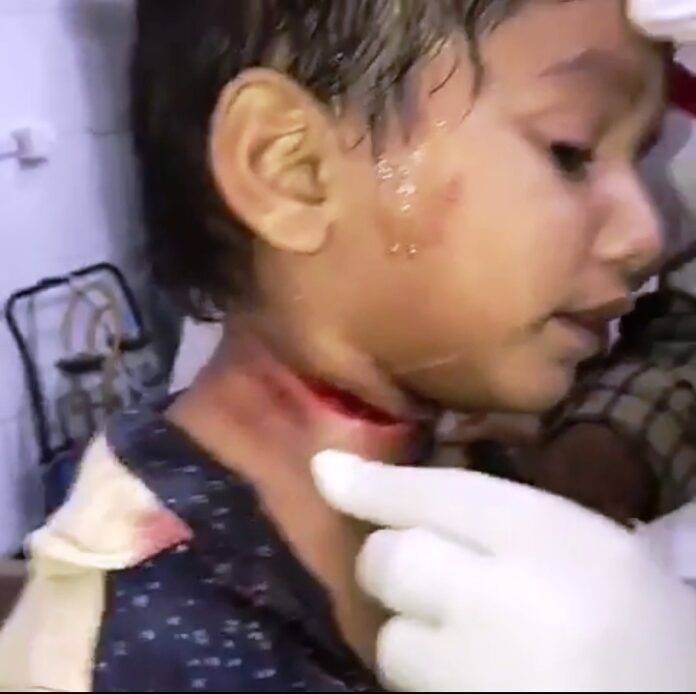 child injured by chinna door 1