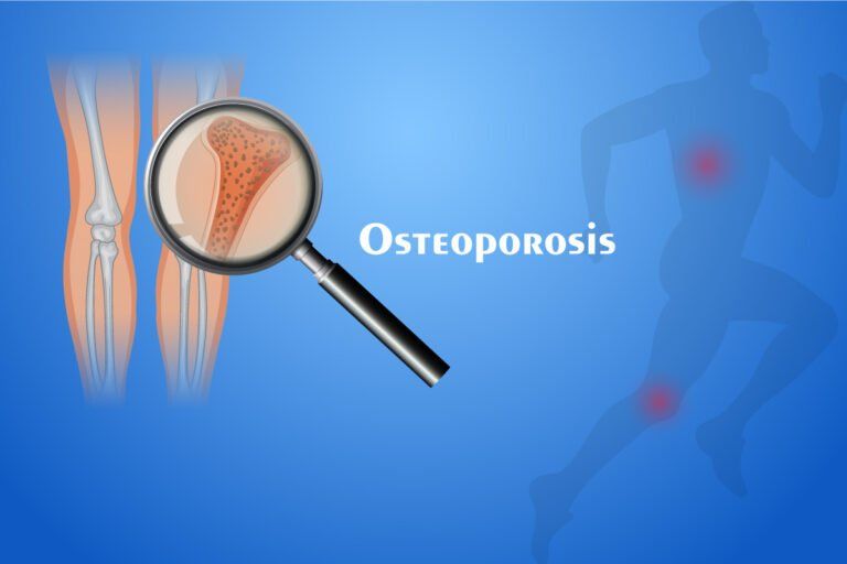 World Osteoporosis Day – Healthy Bones for a Healthy India