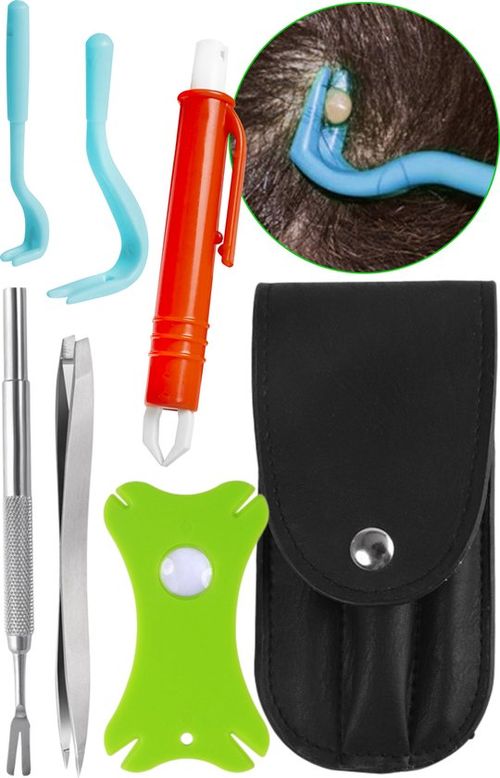 Nuvance - Zeckenzangenset 6...