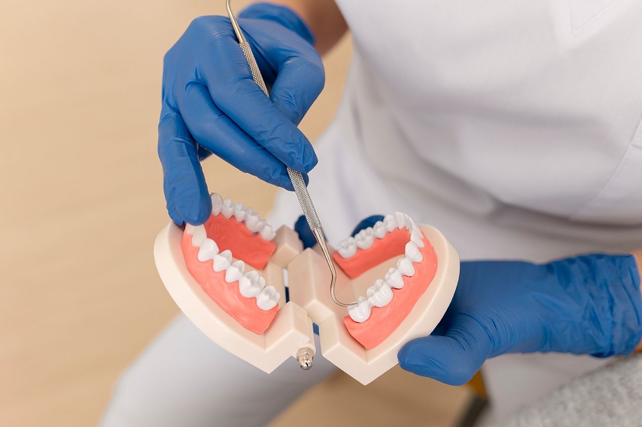 The Ultimate Guide to Full-Mouth Dental Implants: Benefits and Costs