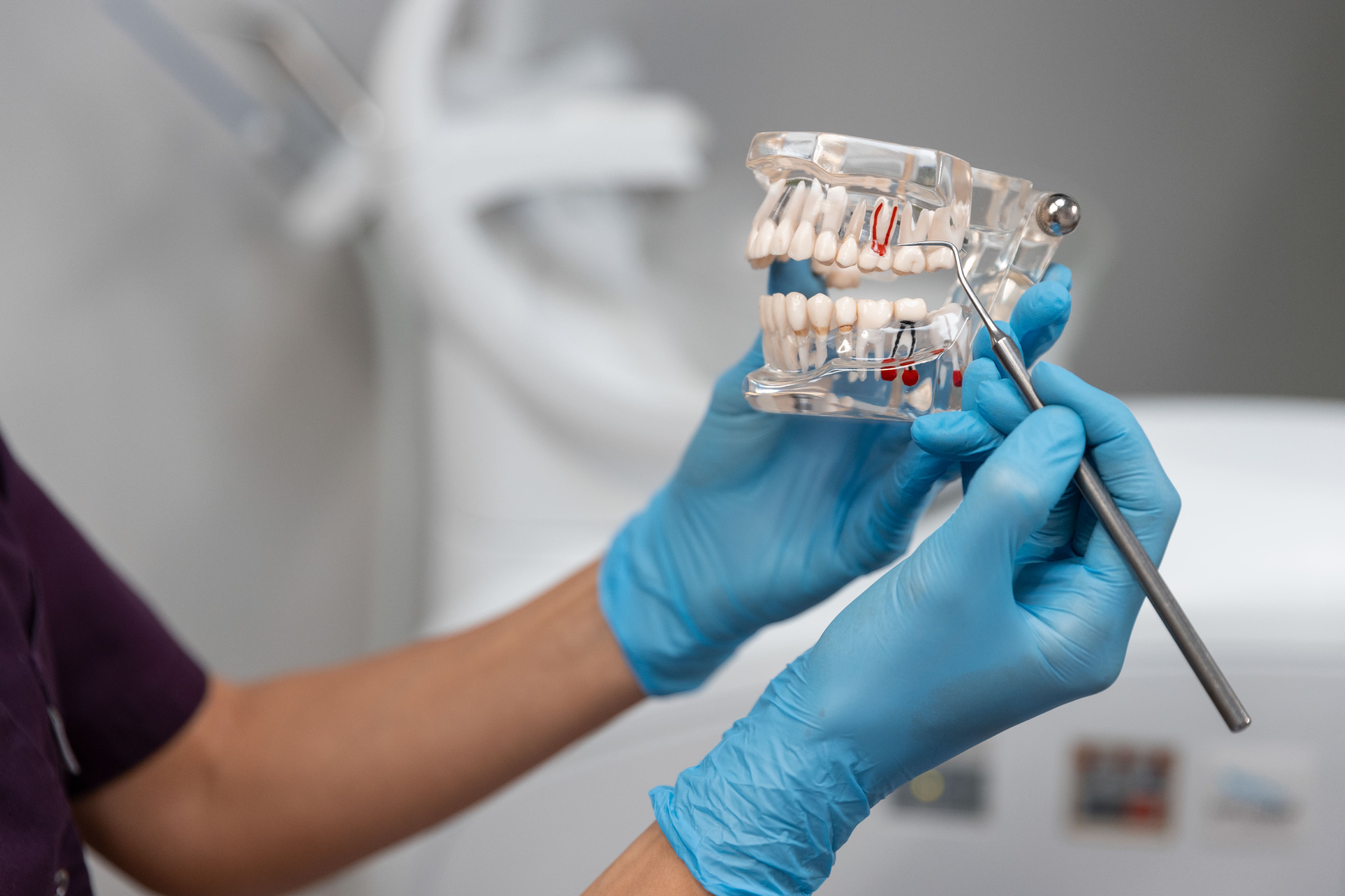 Is It Time for Dental Implants? 5 Signs to Find Out