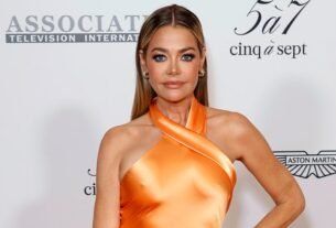 denise richards facelift results social