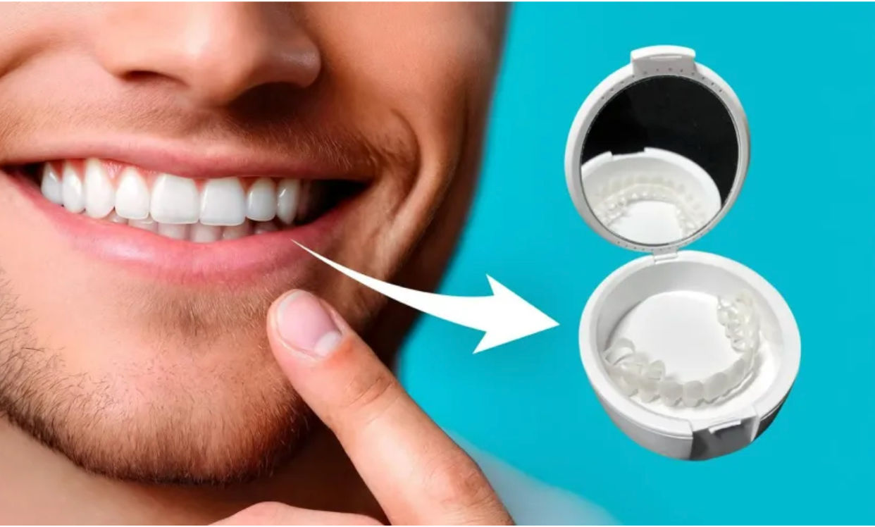 Shiny Smile Veneers 2026: Claims Examined, Pricing Verified & What Consumers Should Confirm Before Buying 1 shiny smile veneers