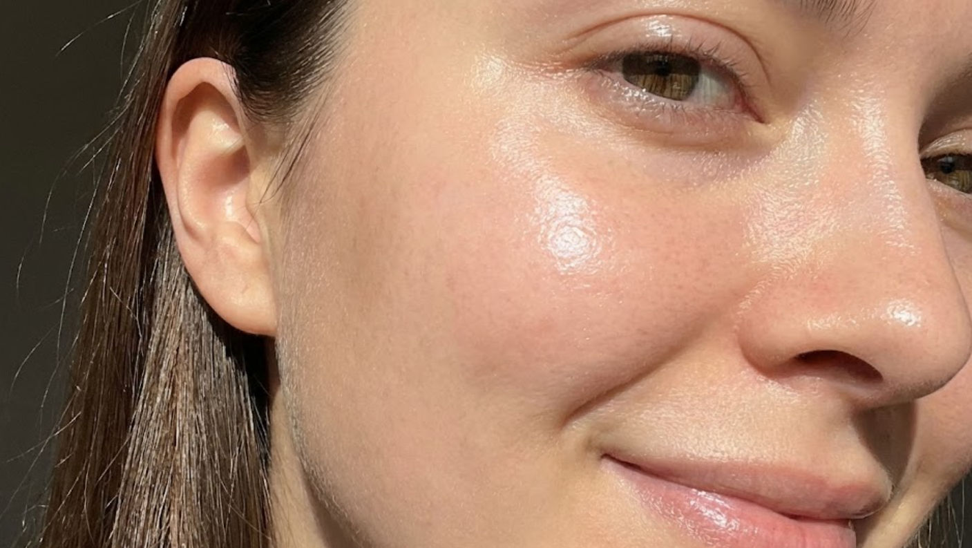 Diferencia entre Spa Médico y Spa de Hotel en Mérida: Tratamientos faciales clínicos y rejuvenecimiento de piel en Ella Skin & Spa Wellness