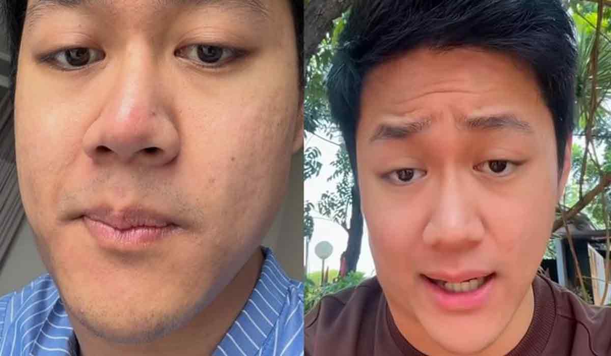 Di Usia Muda 25 Tahun, Pria Jakut Divonis Limfoma, Ini Penyebabnya!