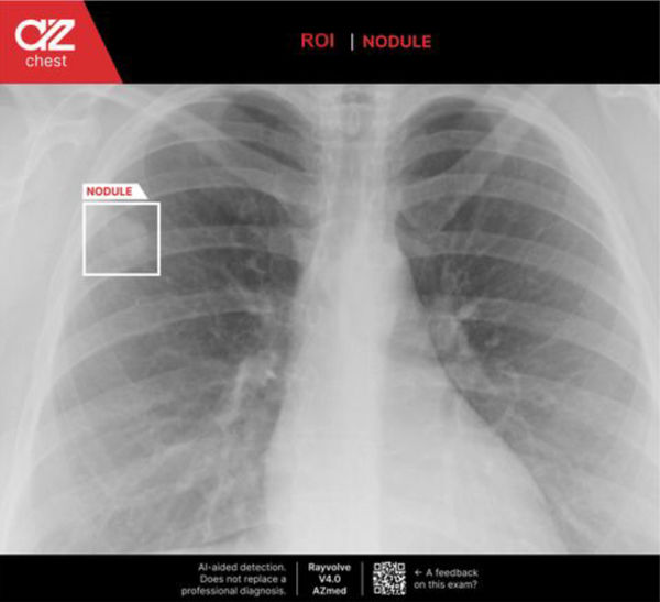 Screenshot of AZchest