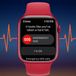 Apple Watch ECG Saves Pregnant Woman and Baby