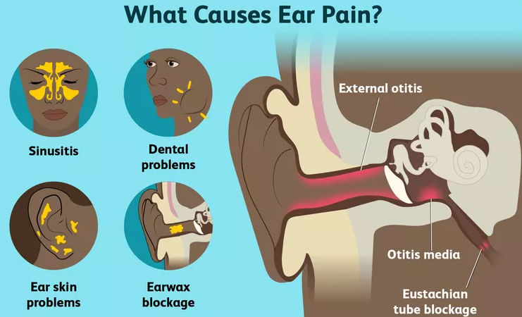 Ear Pain